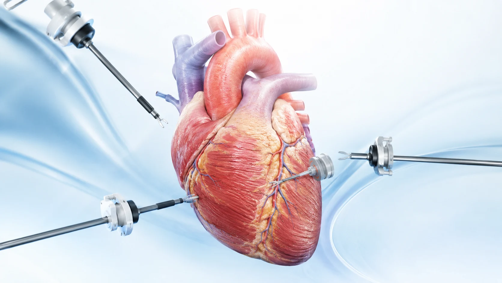 Who Is a Good Candidate for Minimally Invasive Heart Surgery?